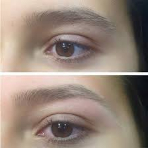 Brows before after-790